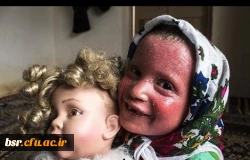 گزارش جمع آوری کمک برای کودک بیمار پوستی